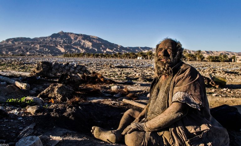 Ewww! This Man Hasn’t Taken A Bath In 65 Years