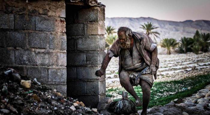 Ewww! This Man Hasn’t Taken A Bath In 65 Years