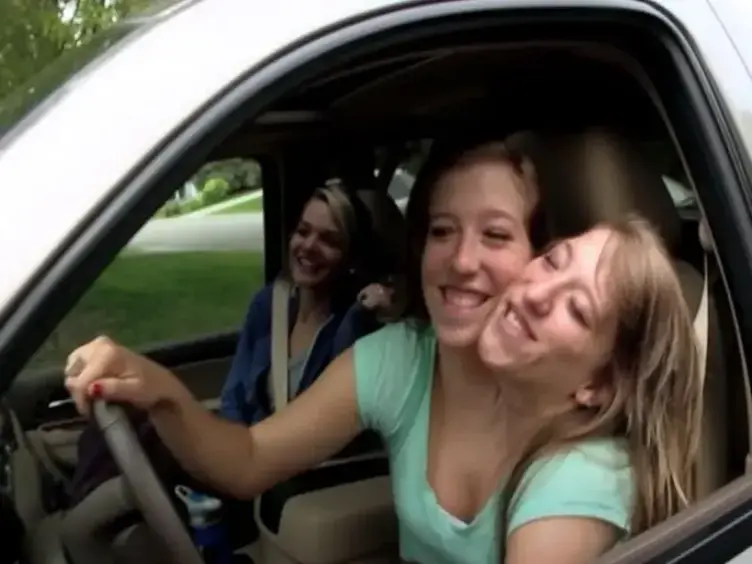 Years After These Siamese Twins Were Born, They Have Something To Share