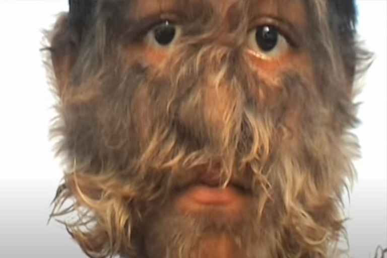 Hairiest family in the world shares shocking news