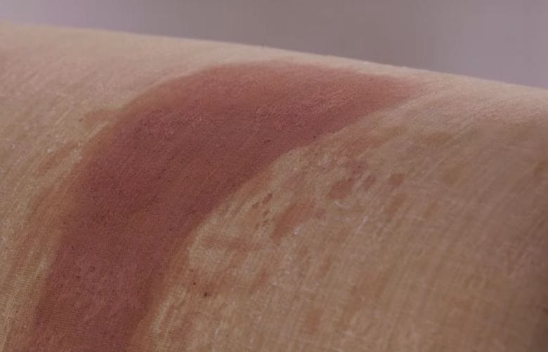 Spilled something on your sofa? With this simple solution it'll look as good as new again!