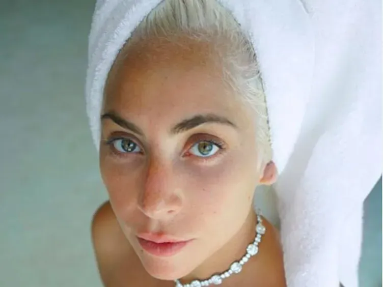 Before The Glam Squad: See How These Top Celebs Really Look!