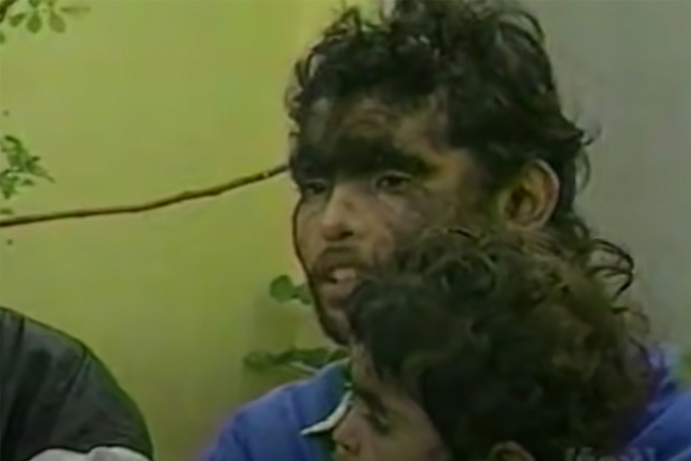 Hairiest family in the world shares shocking news