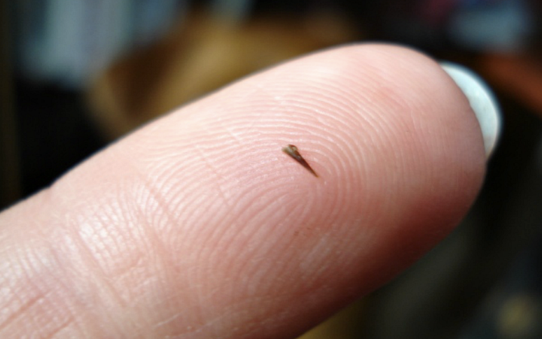 Handy: how to remove a splinter on your own