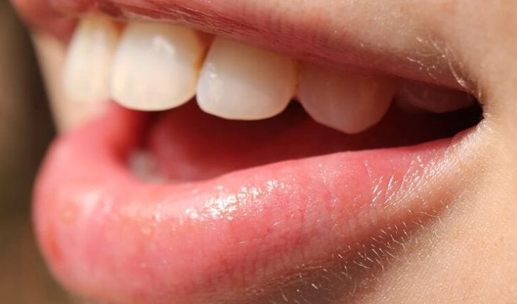 This is how you can soothe a burnt tongue within 10 seconds