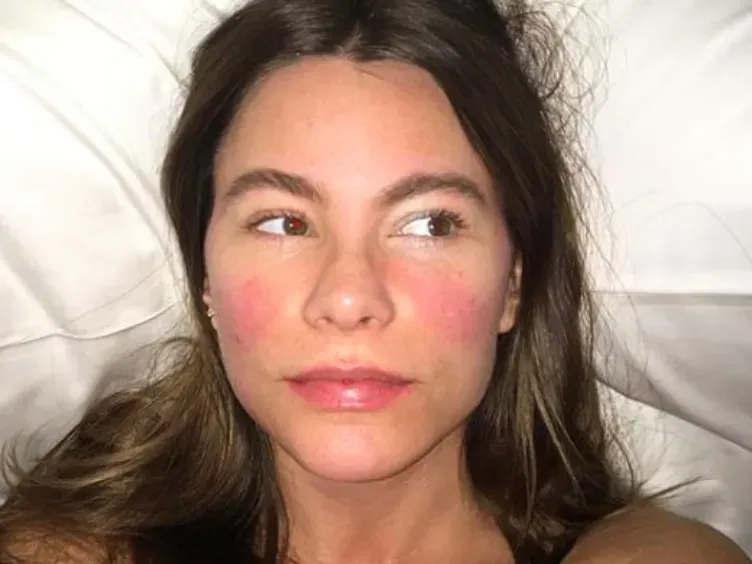 Before The Glam Squad: See How These Top Celebs Really Look!