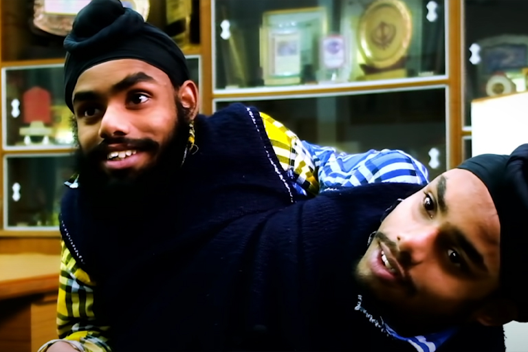 These Siamese Twins Have A Heartfelt Message That The World Needs To Hear
