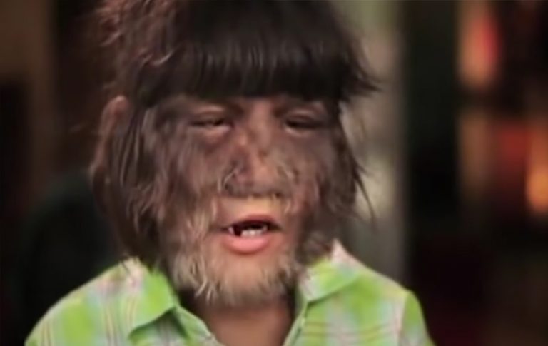 The Hairiest Girl In the World Shaves Her Face For The First Time