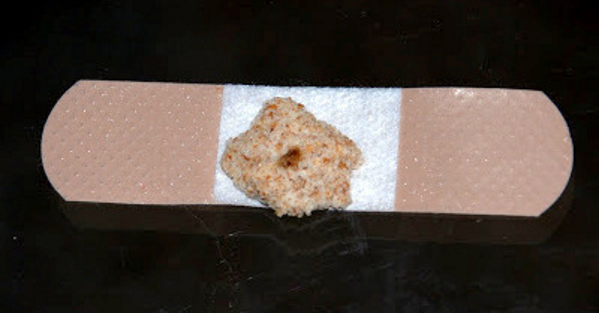 She puts a piece of bread on her child's plaster for a trick we didn't know yet!