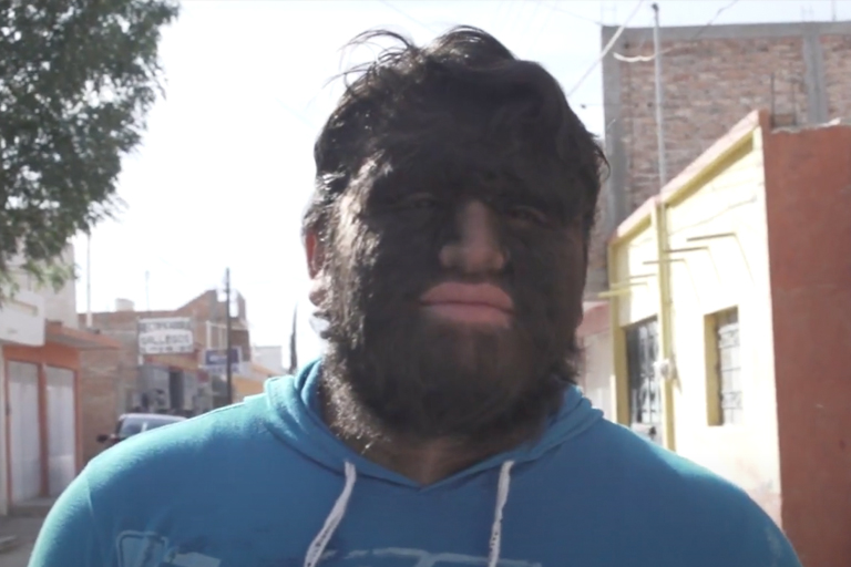 Hairiest family in the world shares shocking news