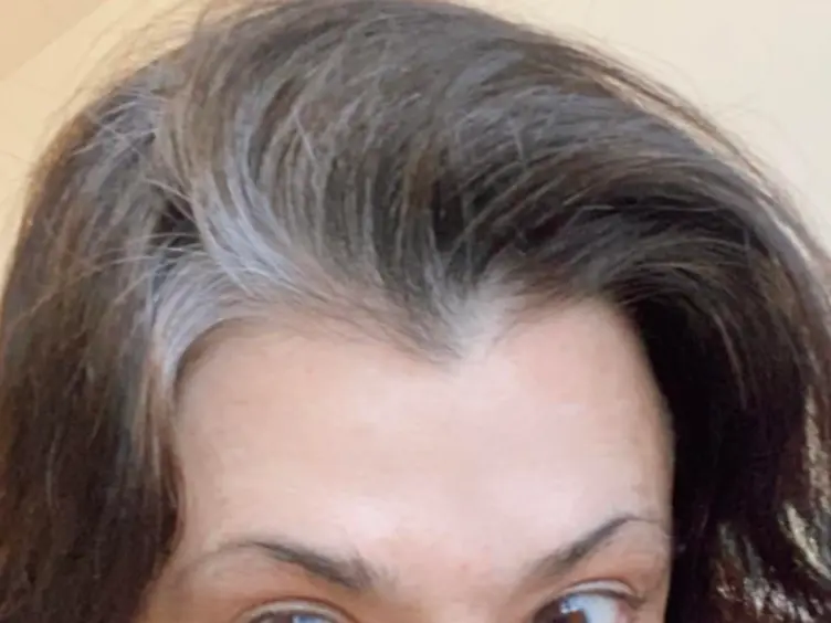 Add Baking Soda To Your Grey Hairs and Watch What Happens