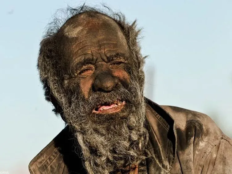Igitt! Dieser Mann hat seit 65 Jahren nicht mehr gebadet