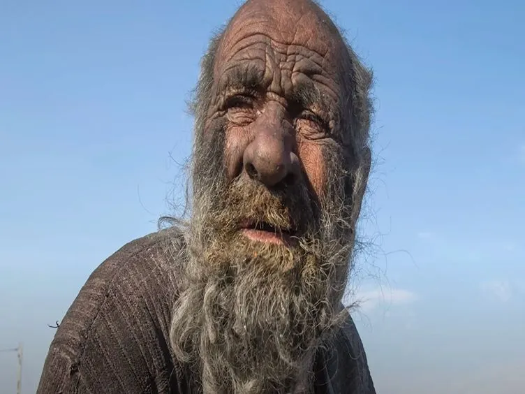 Igitt! Dieser Mann hat seit 65 Jahren nicht mehr gebadet
