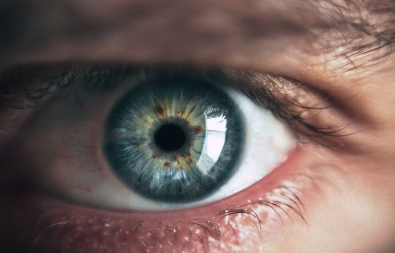 Enxaqueca ocular: estes são os sintomas e como você pode reduzi-los