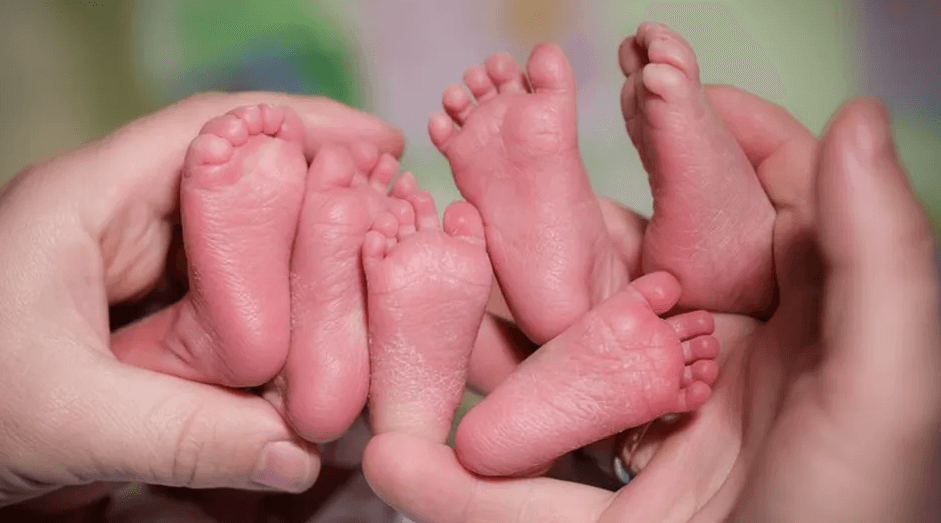 La donna pensa di avere i calcoli renali, ma si scopre che è incinta di tre gemelli
