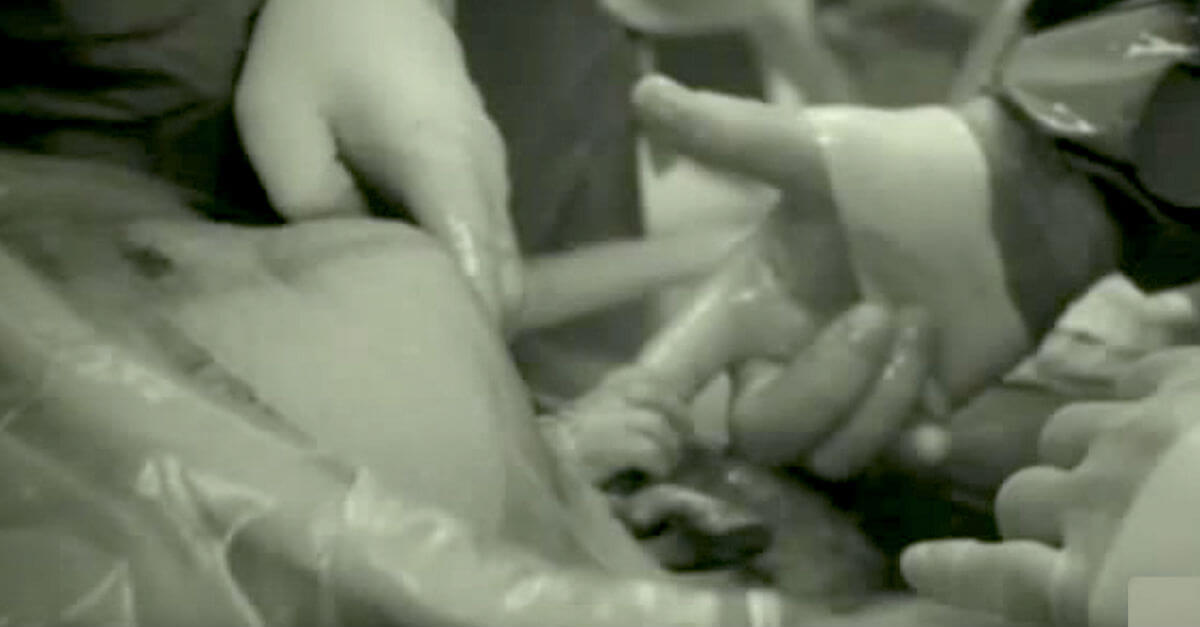 Un padre guarda la mano del medico durante il parto e vede qualcosa di incredibile ...