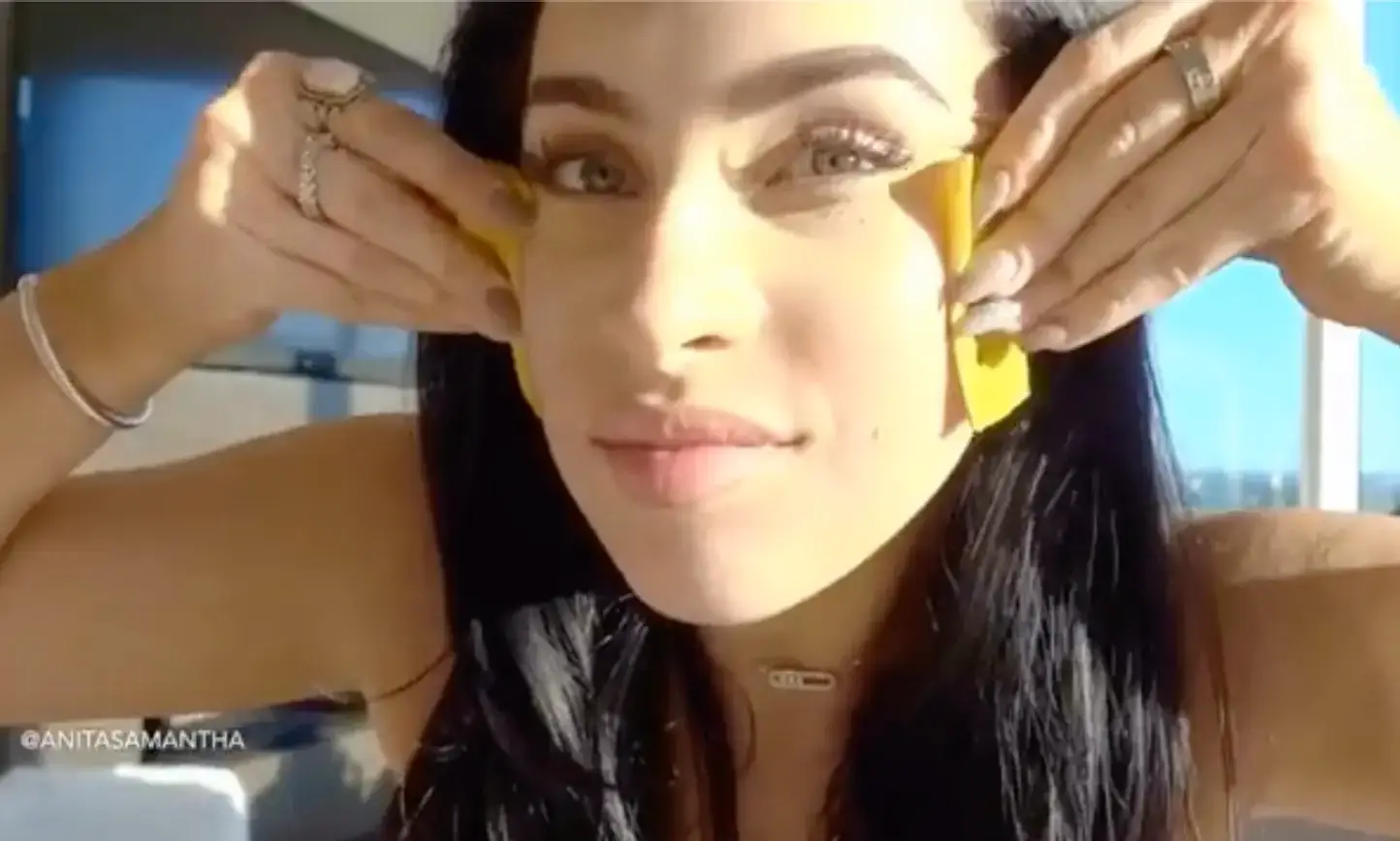 Questa donna si strofina ogni giorno una buccia di banana sui capelli e sul viso e questo è il motivo sorprendente