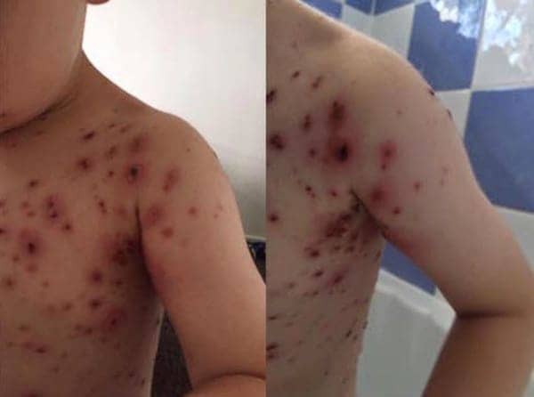 Waarschuwing! Heb je kinderen? Zorg dat ze dit niet overkomt, vreselijk dit verhaal!