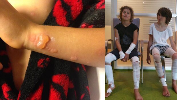 WAARSCHUWING: heb je kinderen? Zorg dan dat dit niet bij ze gebeurt en waarschuw ze voor deze plant!