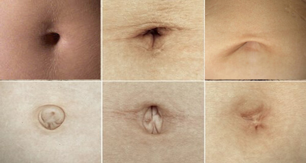 WOW: dit is wat de vorm van je navel zegt over jou! Wat voor navel heb jij?