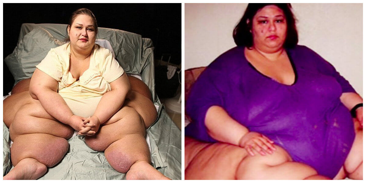 Deze vrouw woog maar liefst 453 kilo en kon haar bed niet verlaten, maar moet je haar NU zien!