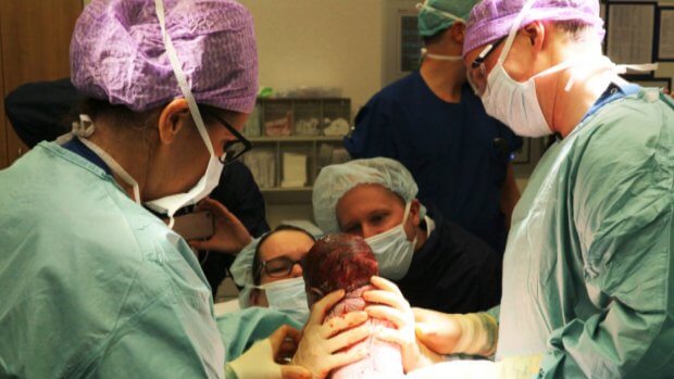 WAUW: moeder haalt zélf haar baby uit haar buik na keizersnede.. Wat een wonder, dit moet je zien!