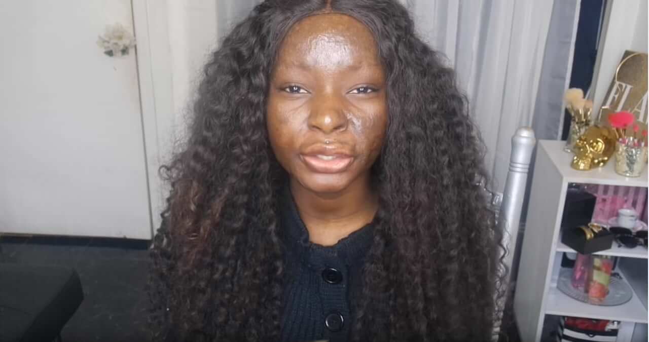Deze bekende Amerikaanse beautyblogger met brandwonden laat zien wat je met make-up allemaal kunt doen! Dit is zo inspirerend!