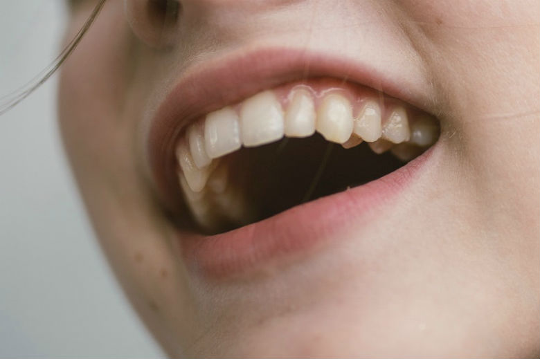 5 natuurlijke geneesmiddelen voor tandvleesontsteking