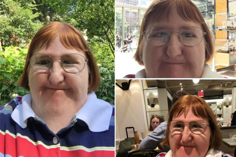 Amerikaanse blogger ‘die te lelijk is' om foto’s te plaatsen slaat terug en krijgt tientallen steunbetuigingen