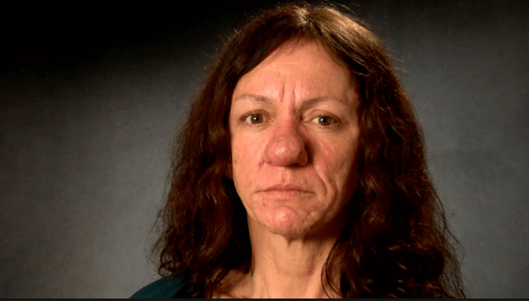 Deze vrouw was diep ongelukkig met haar neus... Moet je haar transformatie eens zien!