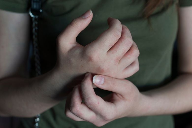 Oei: schurft blijft toenemen onder jongeren