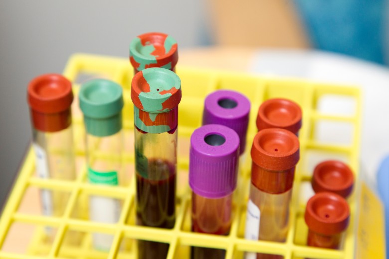 Dit is waarom het coronavirus minder dodelijk is voor vrouwen dan voor mannen