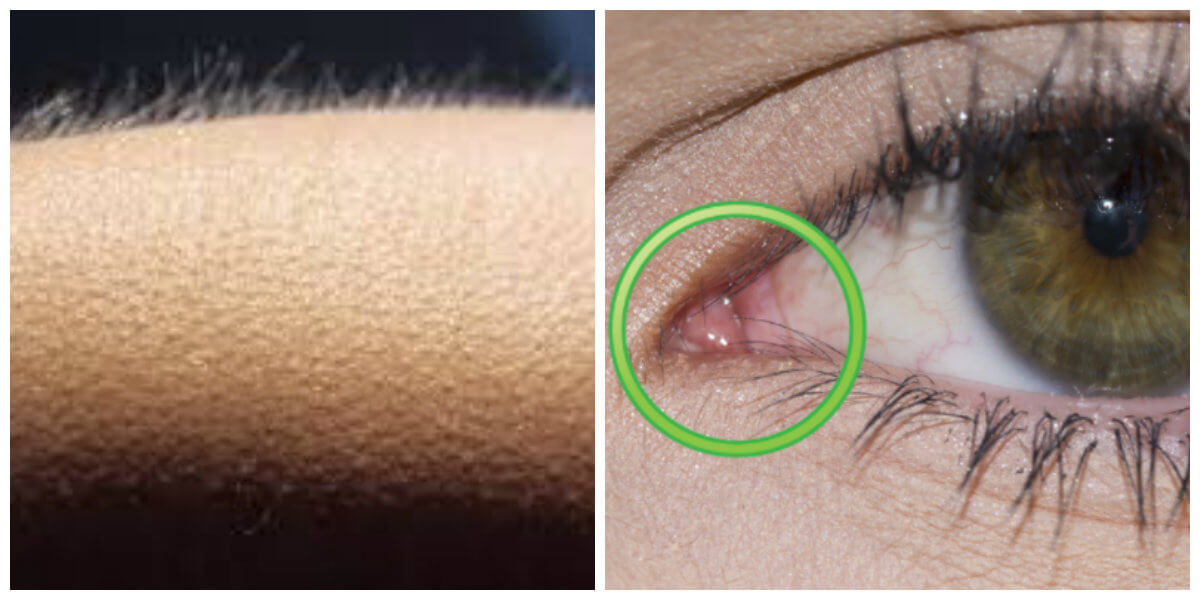 Wauw, DEZE delen van jouw lichaam zijn directe bewijzen van evolutie! Wonderbaarlijk, kijk zelf