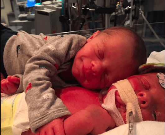 Pasgeboren baby knuffelt stervend tweelingbroertje:  "Hij strekte zijn armpje uit in een omhelzing. Alsof ze wisten dat ze er voor elkaar waren."