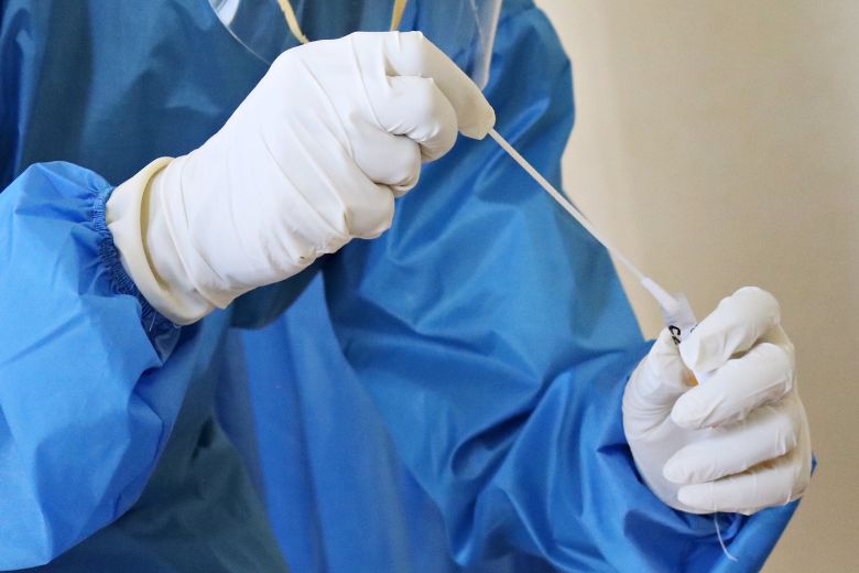 Er komt waarschijnlijk een PCR-test voor schurft