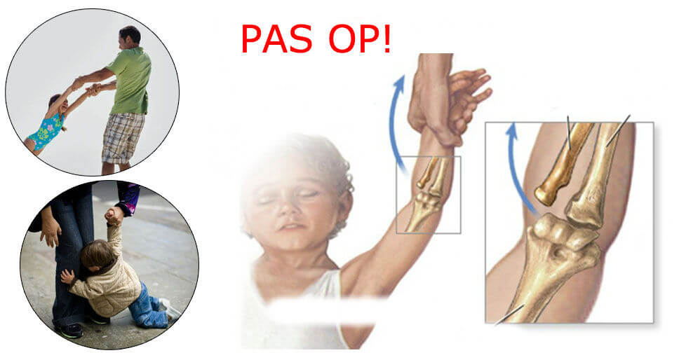 Veel ouders houden hun kinderen zó aan de arm, DIT is waarom je dat nooit moet doen!