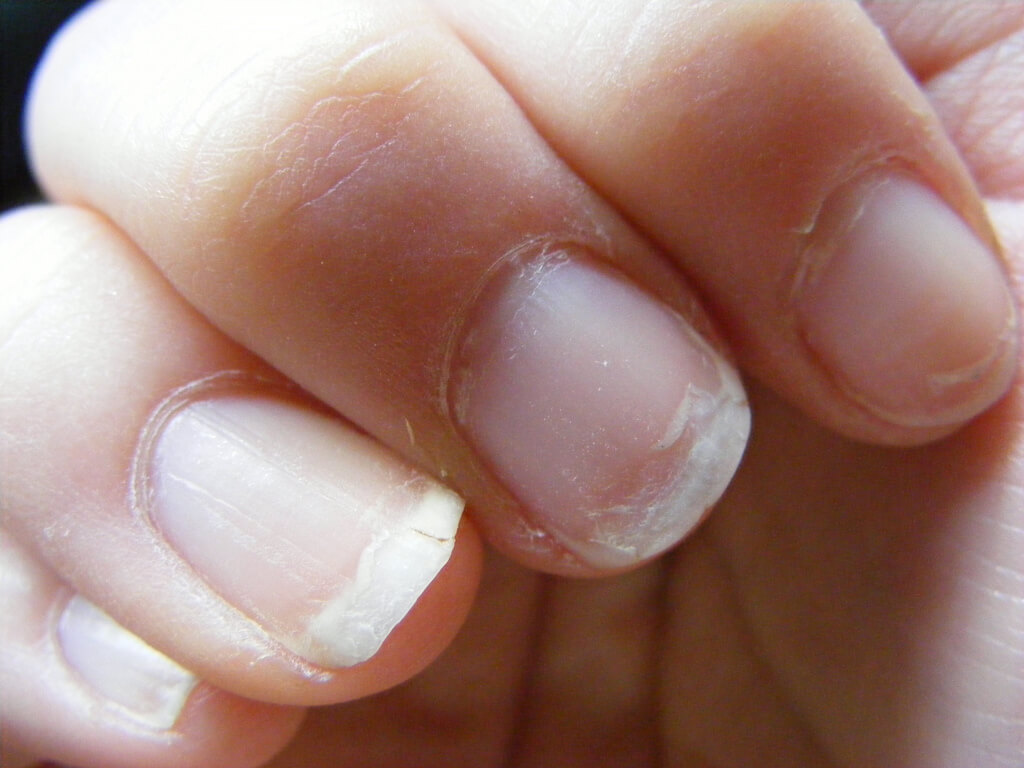 Doe dit verrassende product op je nagels en ze breken minder snel