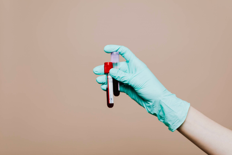Onderzoek toont aan: voor het eerst plastic deeltjes gevonden in menselijk bloed