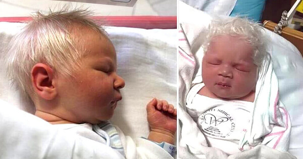 Deze bijzondere baby werd geboren met sneeuwwit haar, heb je ooit zoiets gezien?