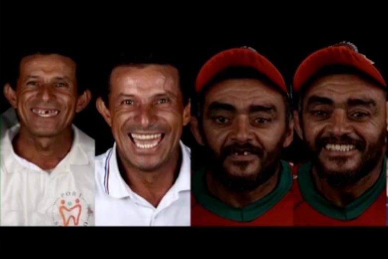 Braziliaanse tandarts helpt arme mensen gratis met nieuw gebit