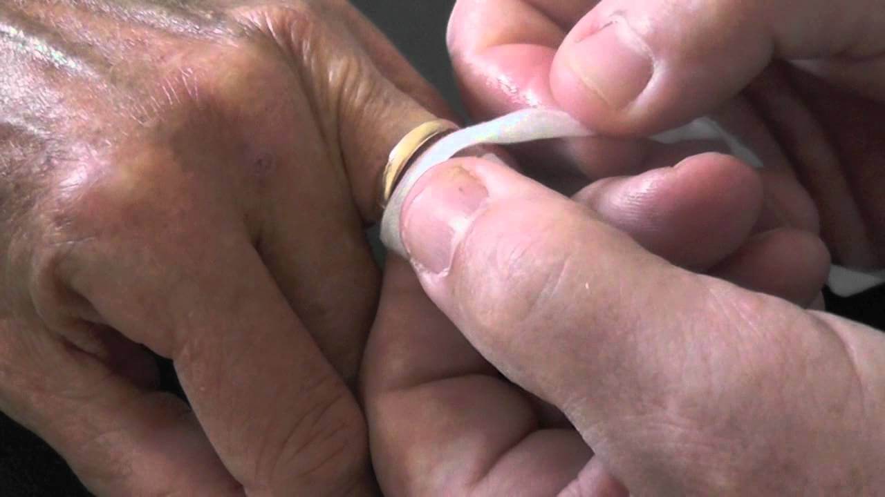 Zo krijg je een vastzittende ring los zónder de ring kapot te maken!