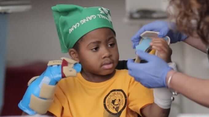 Duim omhoog voor Zion! Deze 8-jarige bikkel is de eerste met een dubbele handtransplantatie.