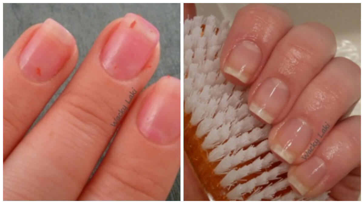 vingernagels