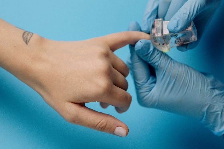 Heb je last van gele nagels? Hier kan het allemaal door komen
