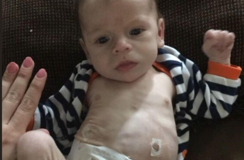 Deze arme baby werd geboren met een drugsverslaving en was doodziek... Maar moet je hem nu zien!