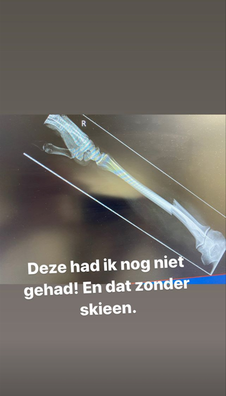 Wolter Kroes gebroken arm