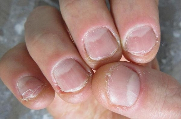 Bijt jij wel eens op je nagels? Dat komt hierdoor en met DIT stappenplan kom je er weer vanaf! Op naar mooie nagels!