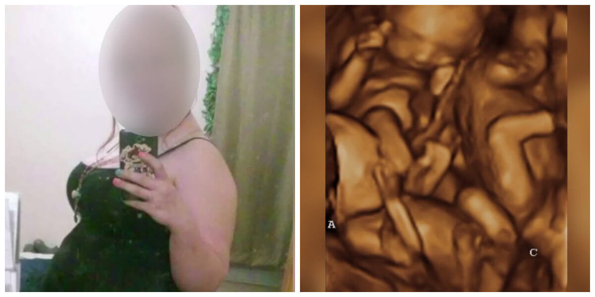 Zij was maar liefst 10 maanden zwanger van een drieling... Maar dit gelukkige babynieuws neemt een wel heel bizarre wending!