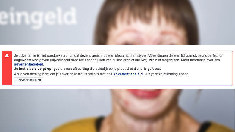 BIZAR: deze advertentie van Brandwonden Stichting wordt geweigerd op Facebook!