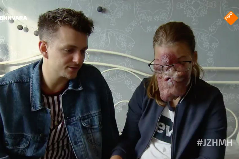 Kijkers diep onder de indruk van Esmee in 'Je Zal Het Maar Hebben'